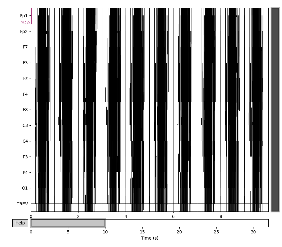 58 fmri gradient artifact