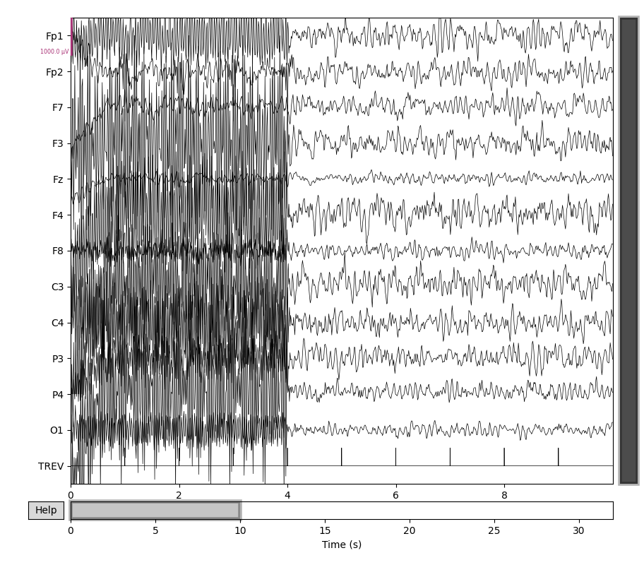 58 fmri gradient artifact