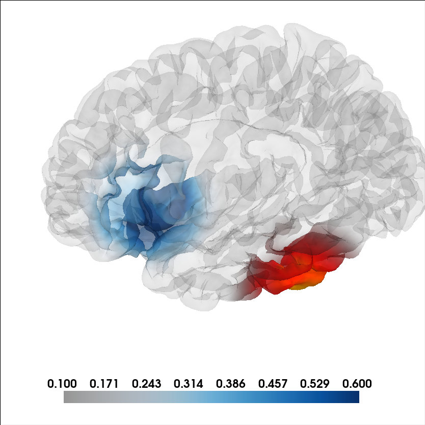 brain