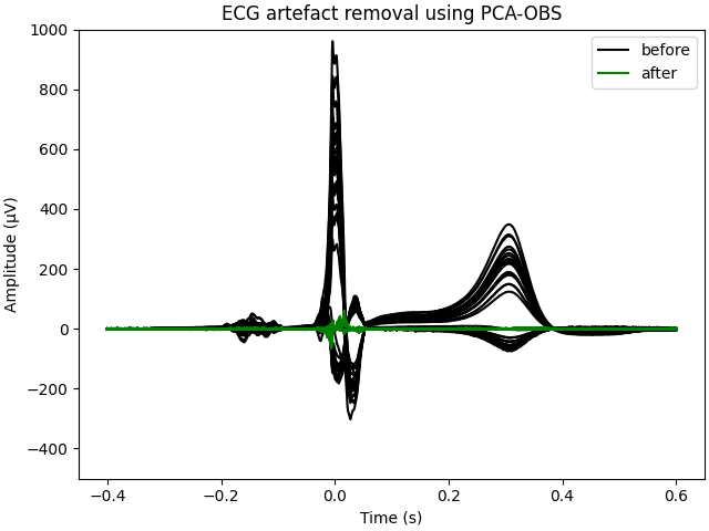 ECG artefact removal using PCA-OBS