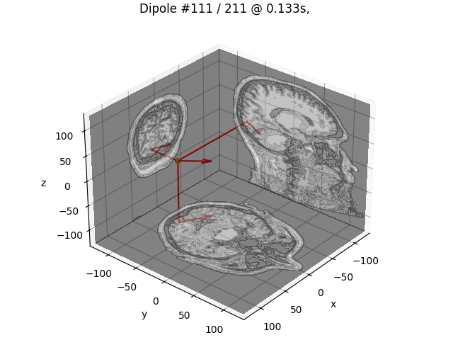 Dipole #111 / 211 @ 0.133s, GOF: 38.1%, 10.0nAm MRI: (16.8, -78.0, 0.5) mm