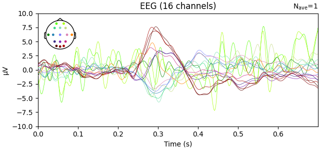 EEG (16 channels)