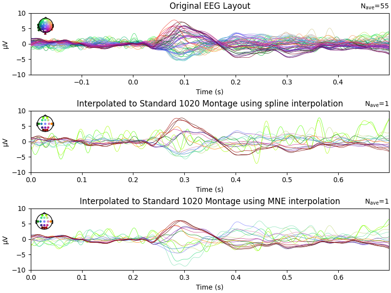 Original EEG Layout, Interpolated to Standard 1020 Montage using spline interpolation, Interpolated to Standard 1020 Montage using MNE interpolation