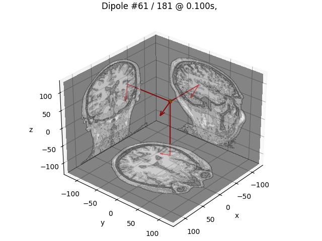 Dipole #61 / 181 @ 0.100s, GOF: 26.1%, 49.8nAm MRI: (-42.7, -20.7, 29.9) mm