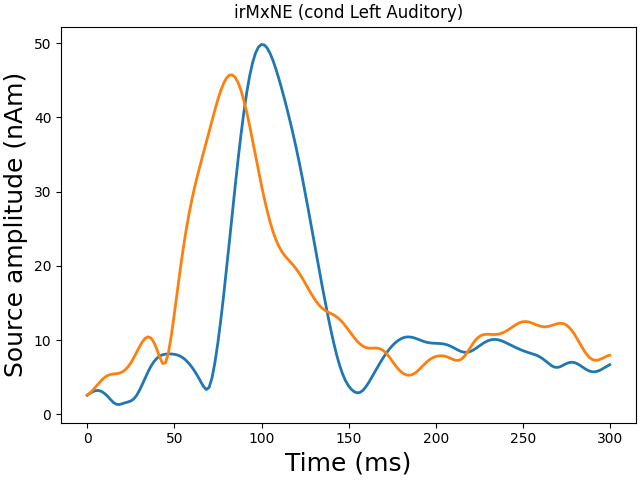 irMxNE (cond Left Auditory)