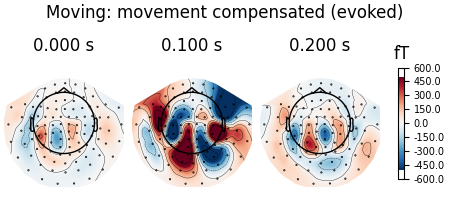 Moving: movement compensated (evoked), 0.000 s, 0.100 s, 0.200 s, fT