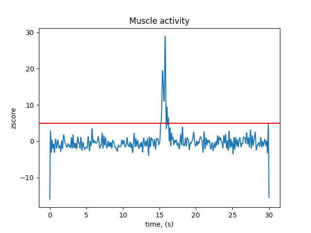 Muscle activity