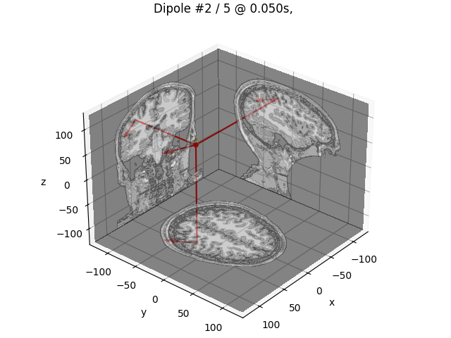 Dipole #2 / 5 @ 0.050s, GOF: 99.7%, 62.4nAm MRI: (42.9, -21.2, 73.0) mm