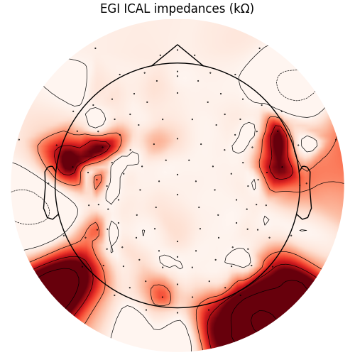 EGI ICAL impedances (kΩ)