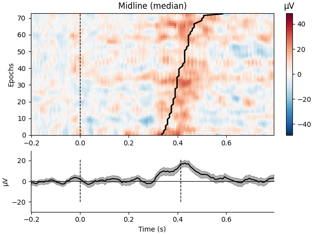 Midline (median), µV