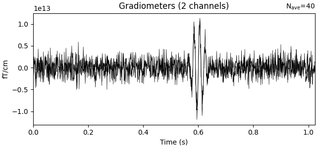 Gradiometers (2 channels)