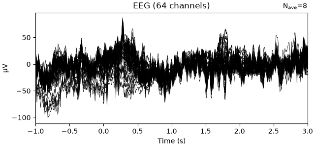 EEG (64 channels)