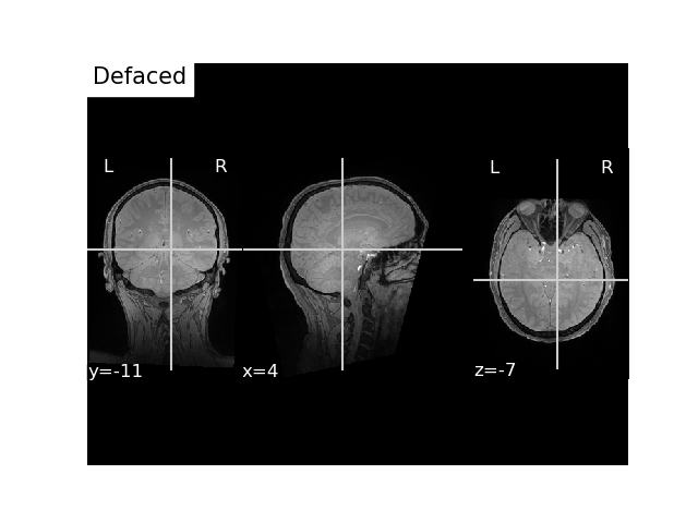 convert mri and trans