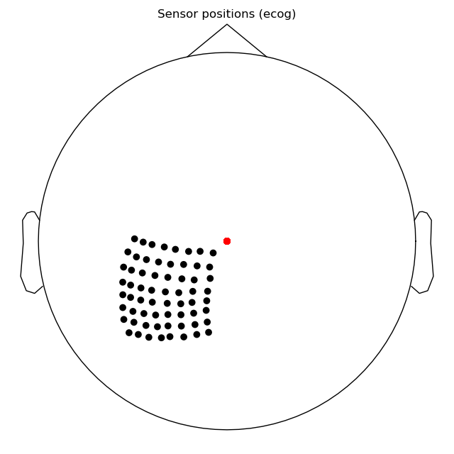 Sensor positions (ecog)