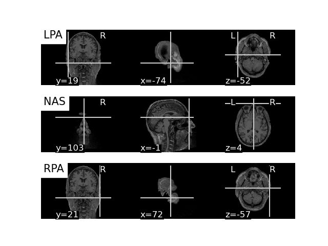 convert mri and trans