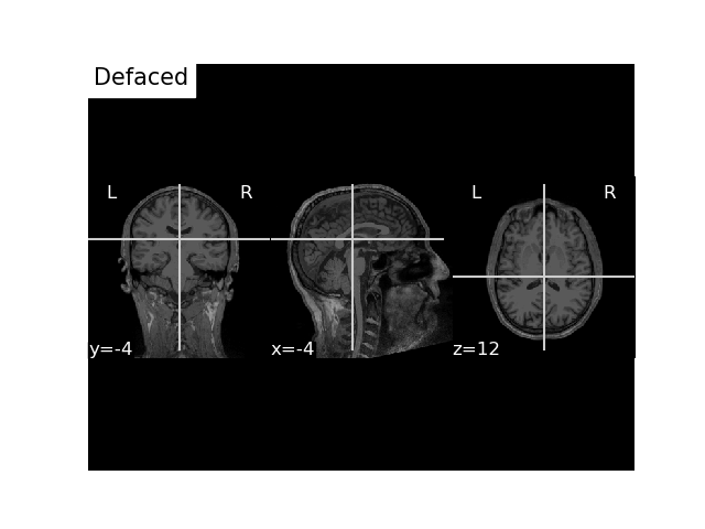 convert mri and trans