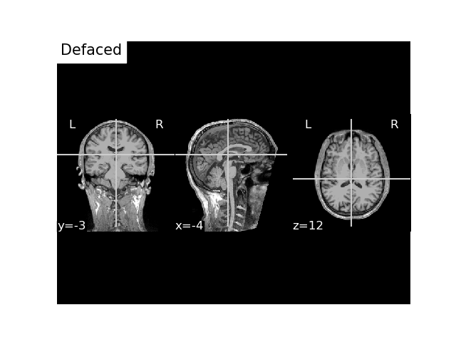 convert mri and trans