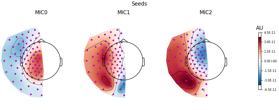 Seeds, MIC0, MIC1, MIC2, AU