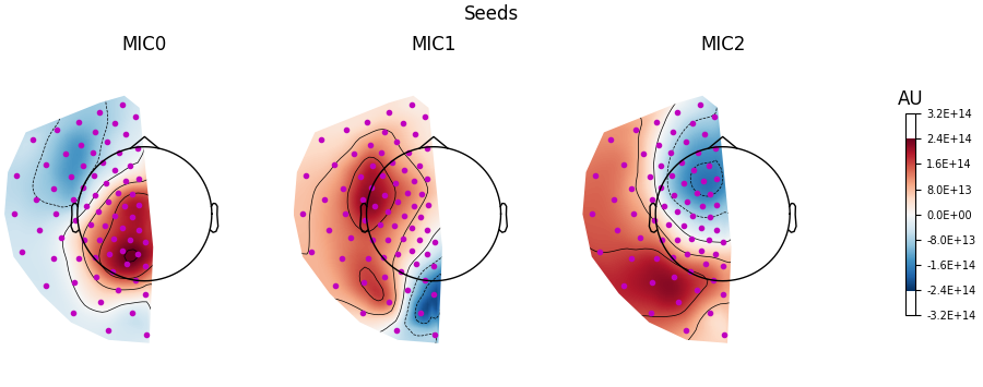 Seeds, MIC0, MIC1, MIC2, AU