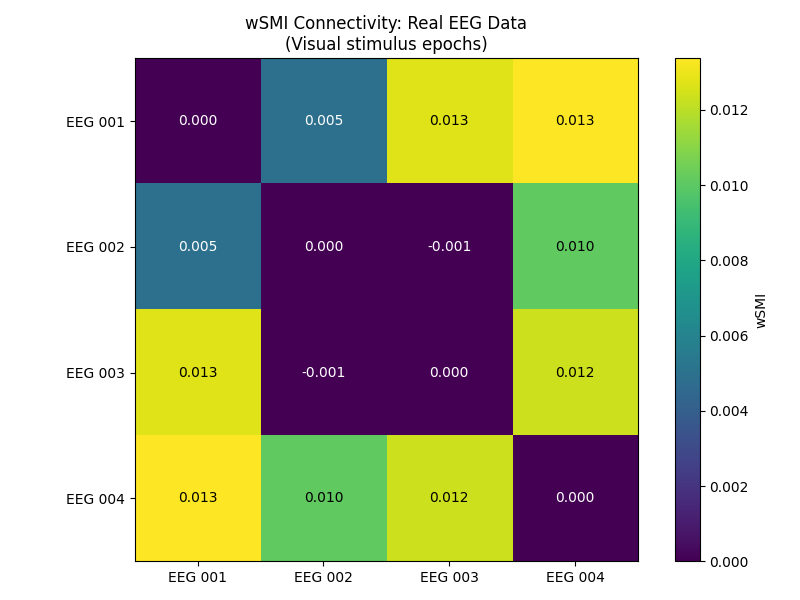 wSMI Connectivity: Real EEG Data (Visual stimulus epochs)