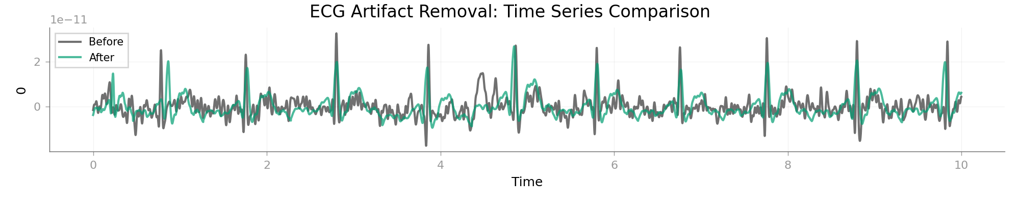 ECG Artifact Removal: Time Series Comparison