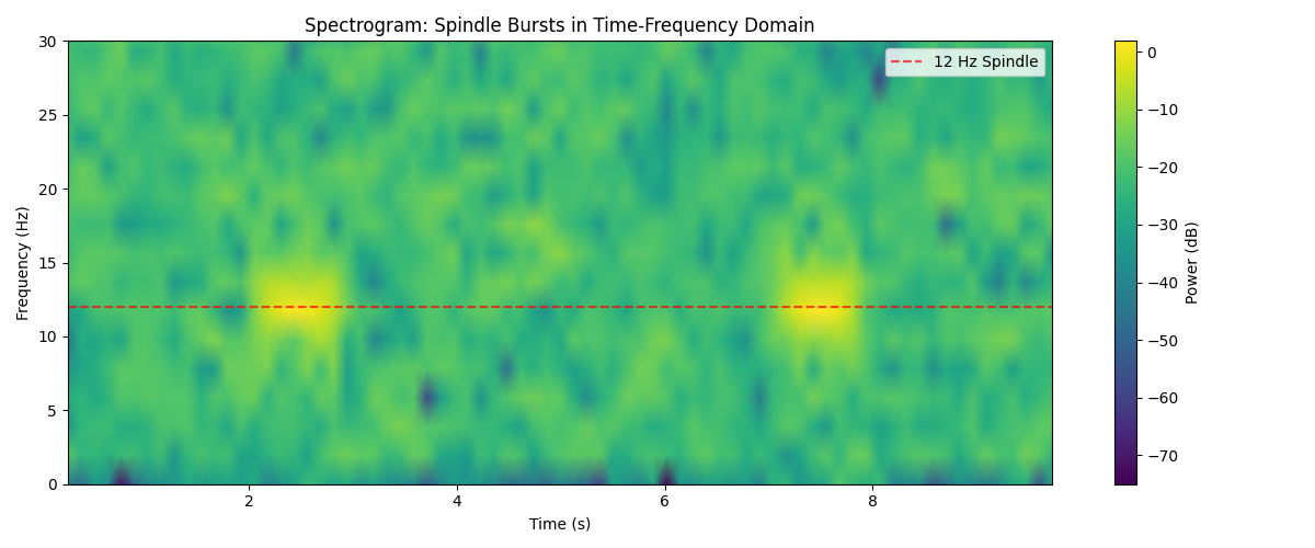 Spectrogram: Spindle Bursts in Time-Frequency Domain