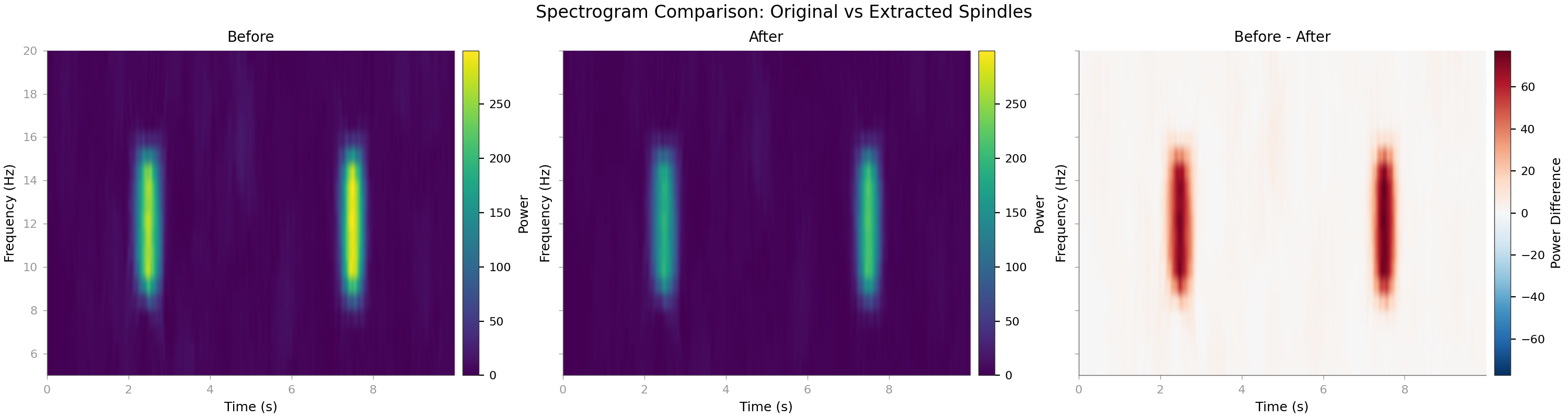 Spectrogram Comparison: Original vs Extracted Spindles, Before, After, Before - After