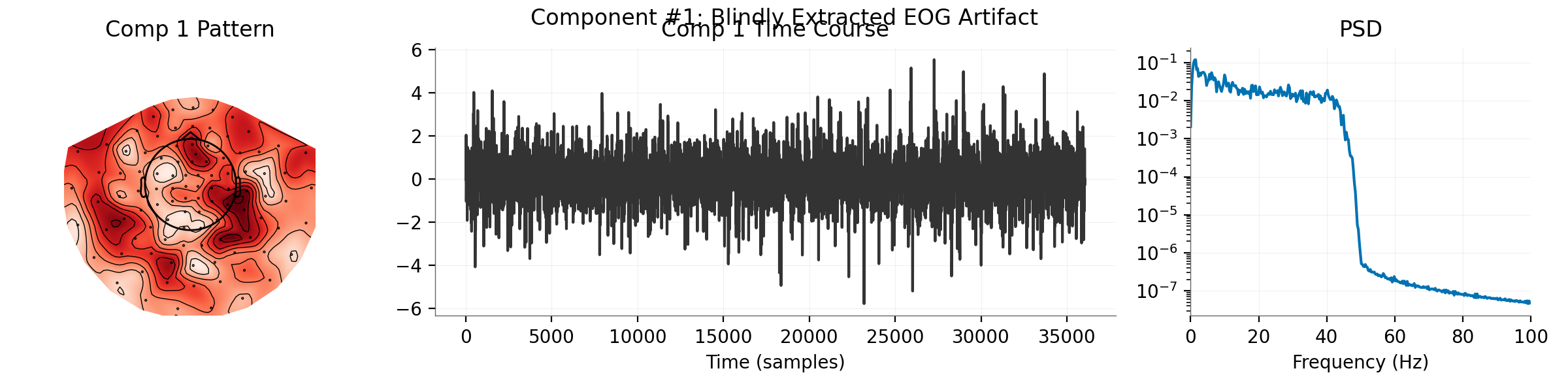 Component #1: Blindly Extracted EOG Artifact, Comp 1 Pattern, Comp 1 Time Course, PSD