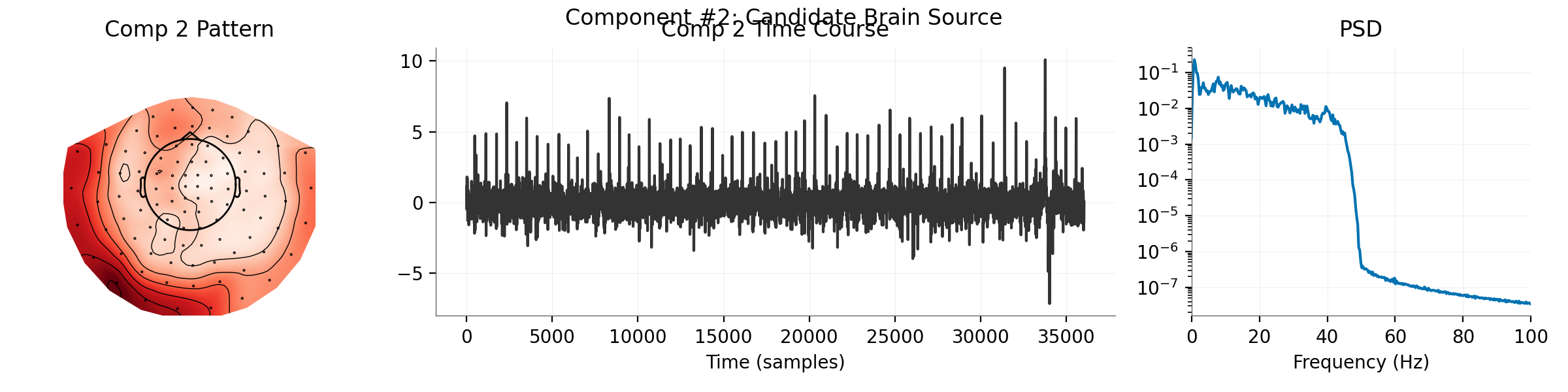 Component #2: Candidate Brain Source, Comp 2 Pattern, Comp 2 Time Course, PSD