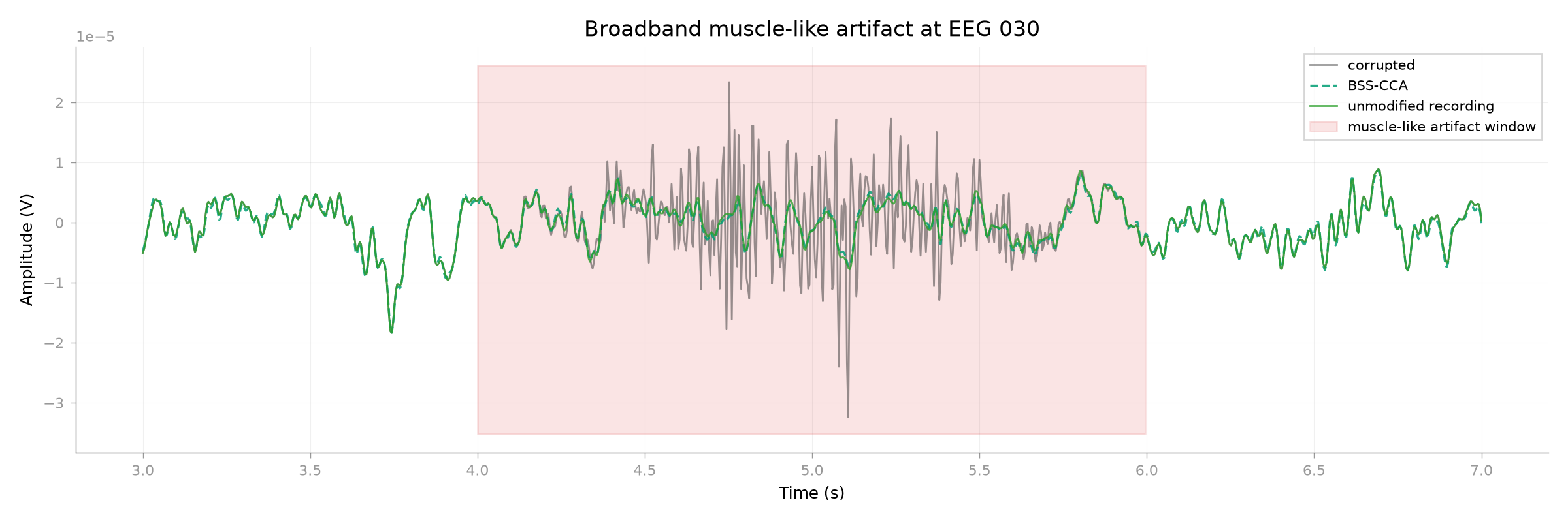 Broadband muscle-like artifact at EEG 030