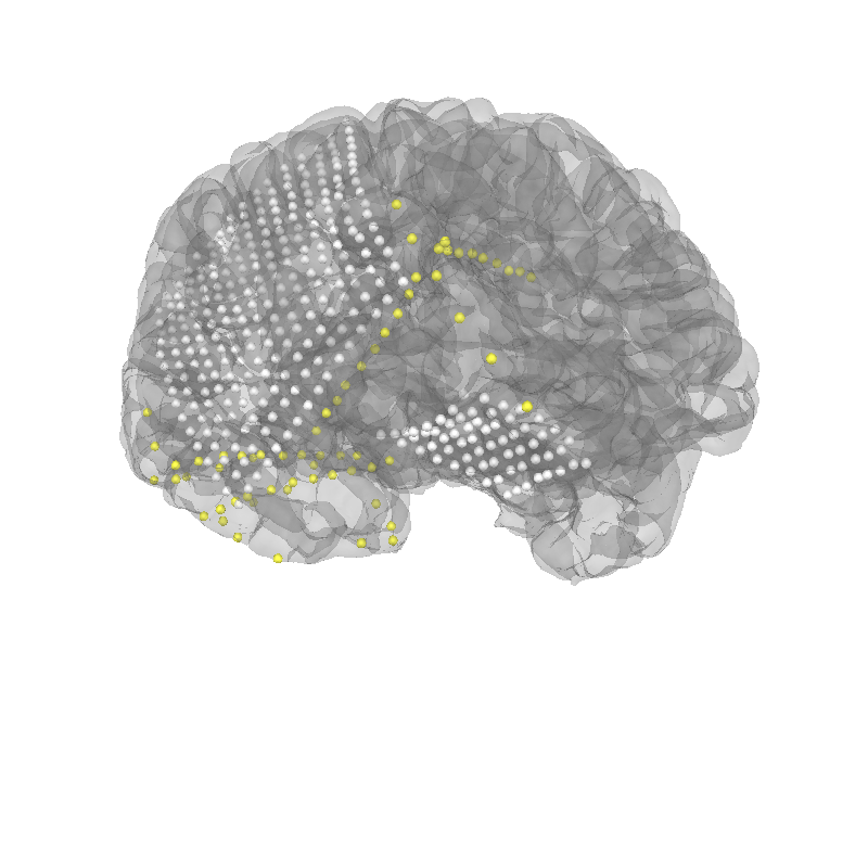 ieeg locate