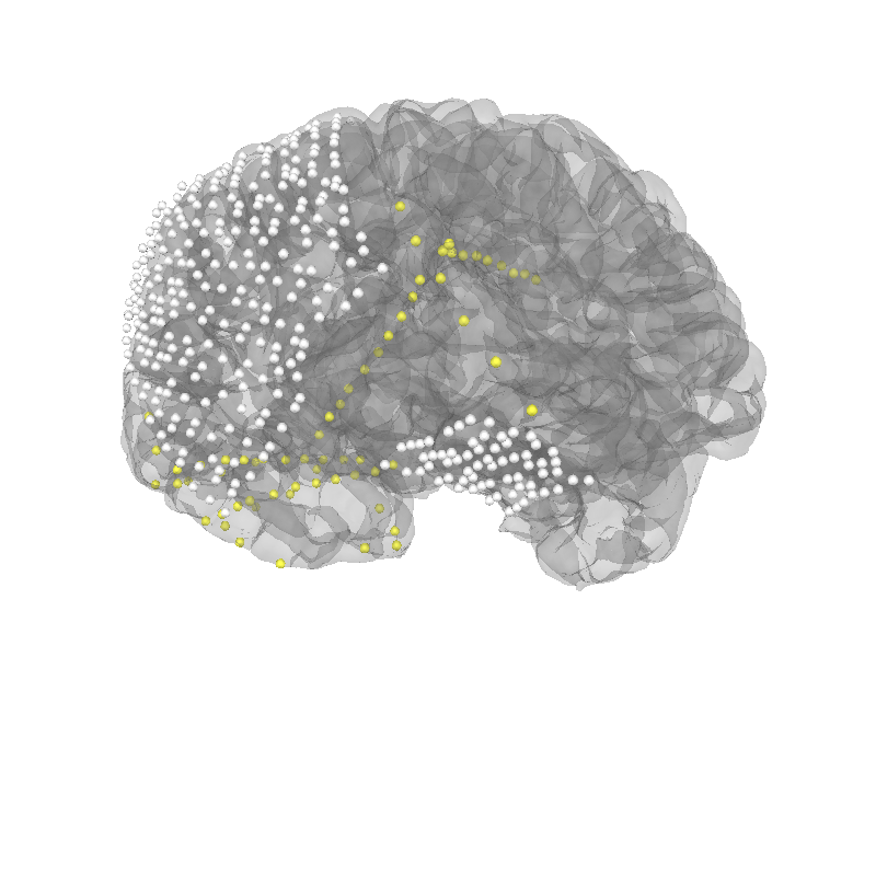 ieeg locate