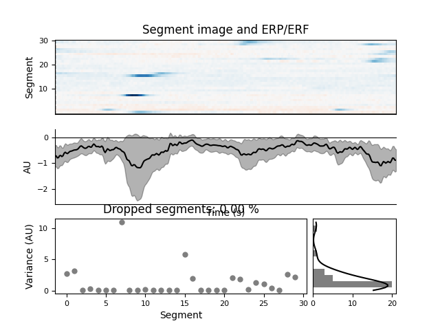 Segment image and ERP/ERF, Dropped segments: 0.00 %