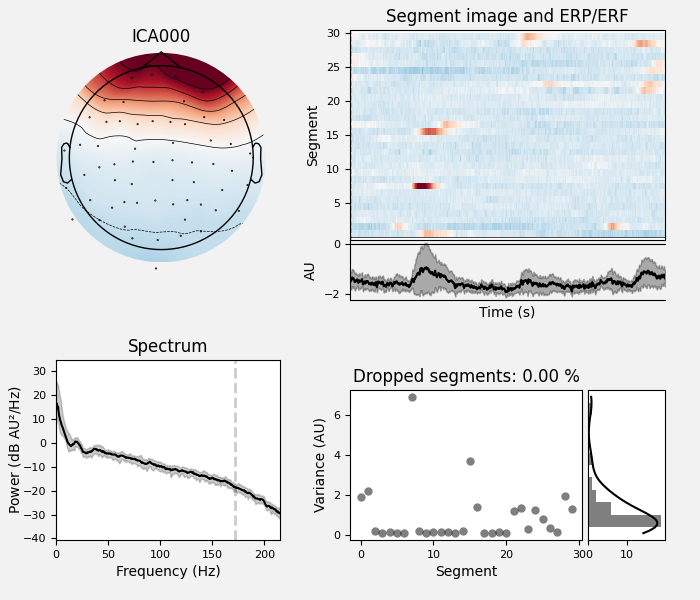 ICA000, Segment image and ERP/ERF, Spectrum, Dropped segments: 0.00 %