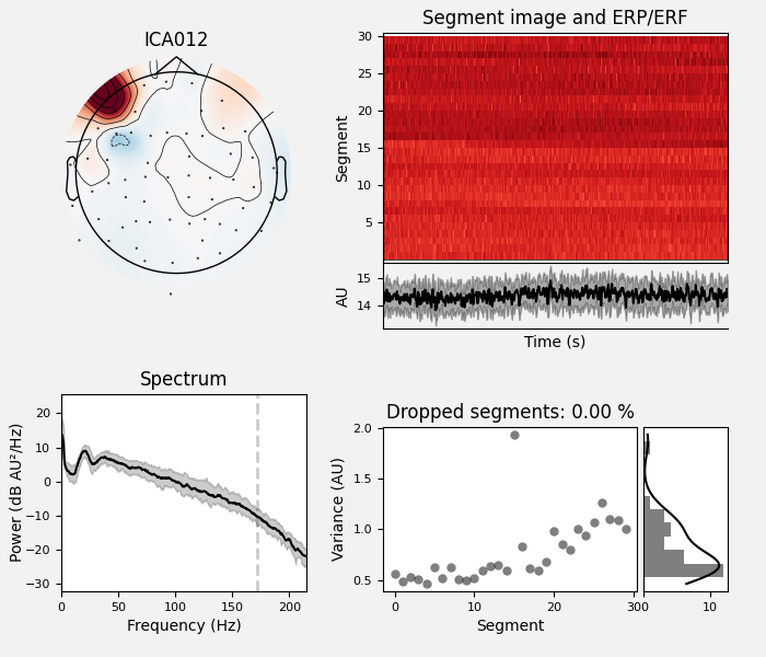 ICA012, Segment image and ERP/ERF, Spectrum, Dropped segments: 0.00 %