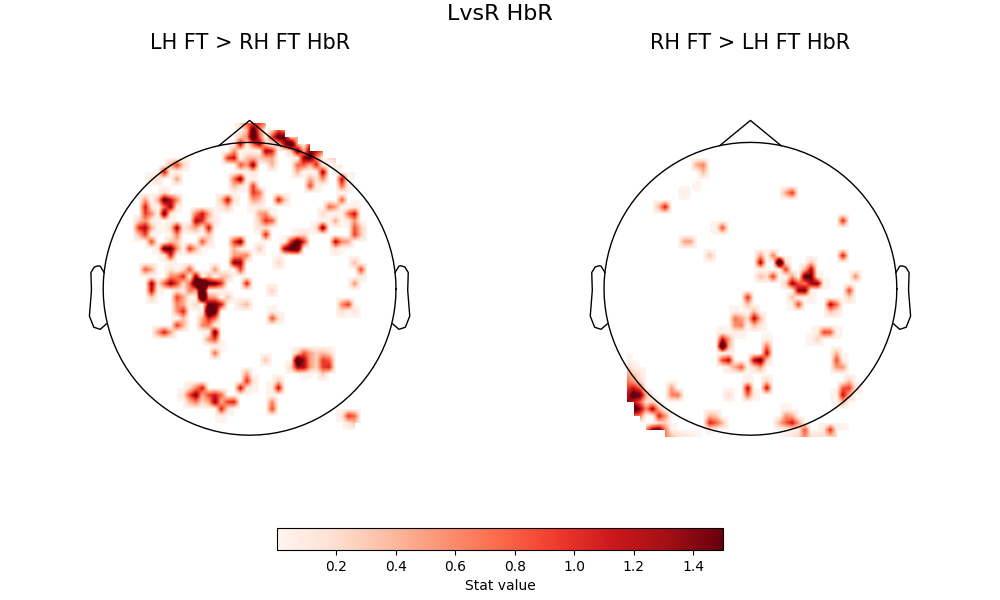 LvsR HbR, LH FT > RH FT HbR, RH FT > LH FT HbR