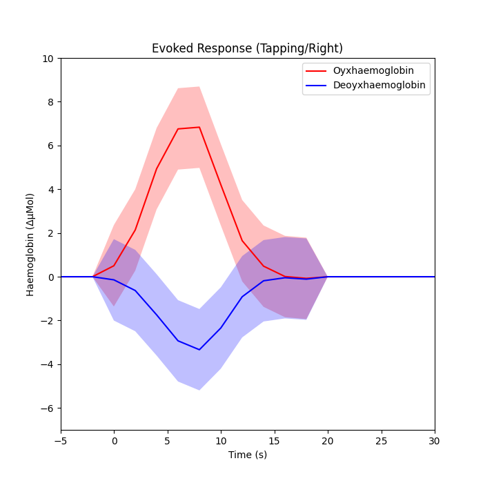 Evoked Response (Tapping/Right)