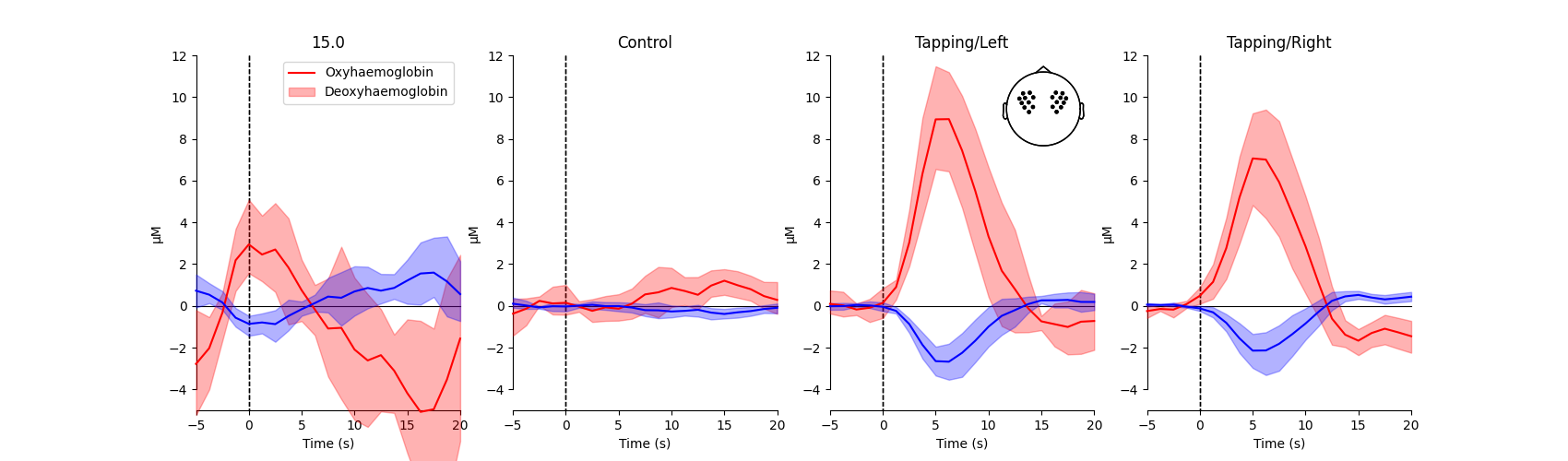 15.0, Control, Tapping/Left, Tapping/Right