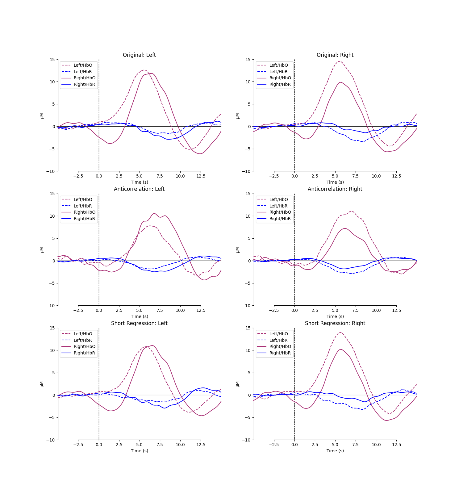 Original: Left, Original: Right, Anticorrelation: Left, Anticorrelation: Right, Short Regression: Left, Short Regression: Right