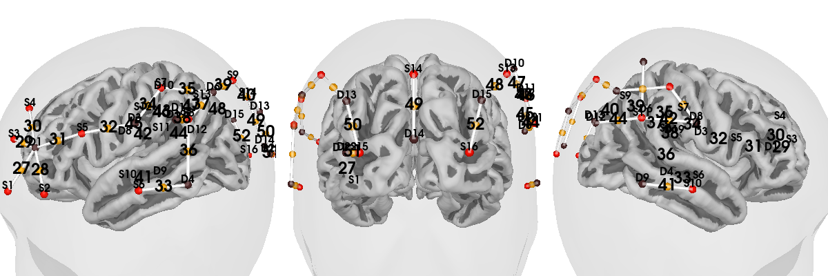 plot 70 visualise brain