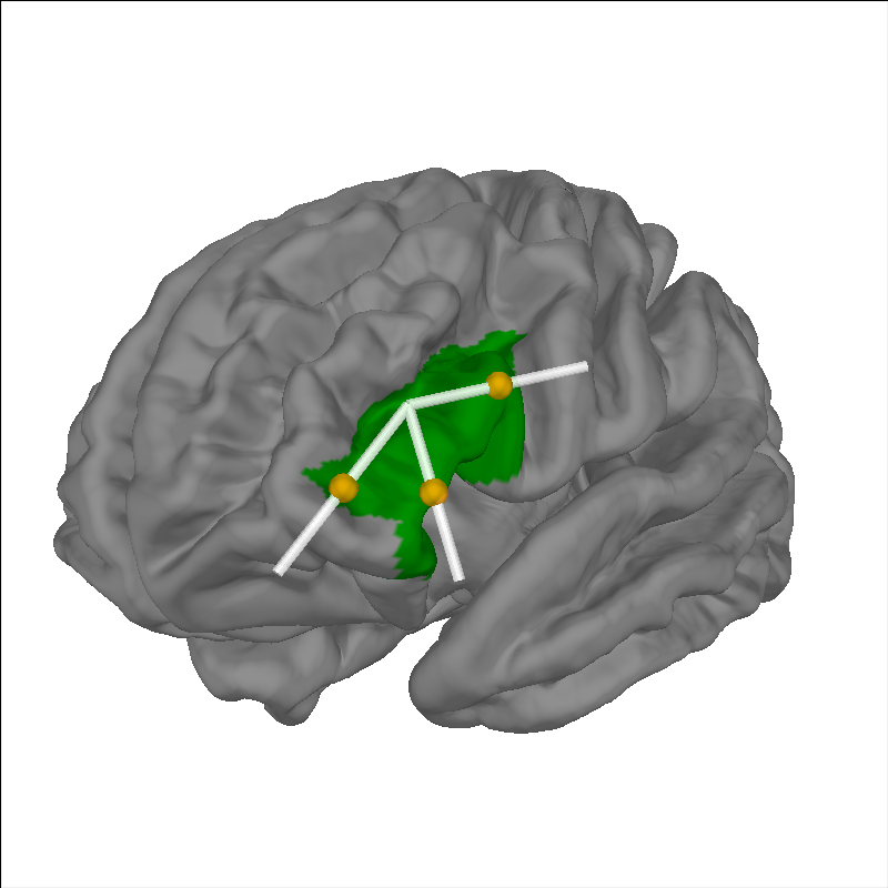 plot 70 visualise brain