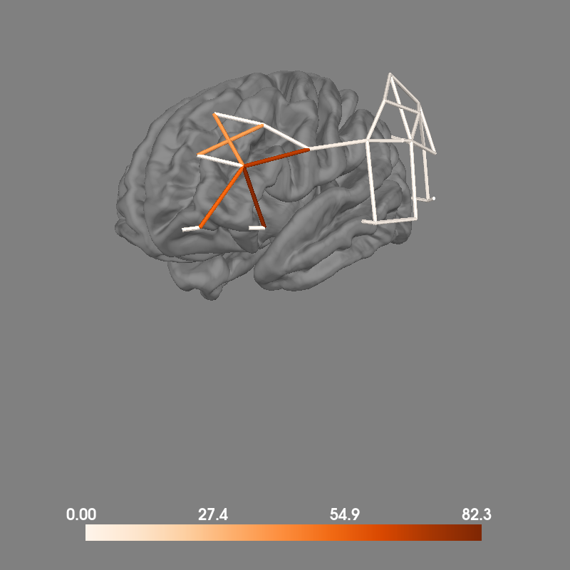 plot 70 visualise brain