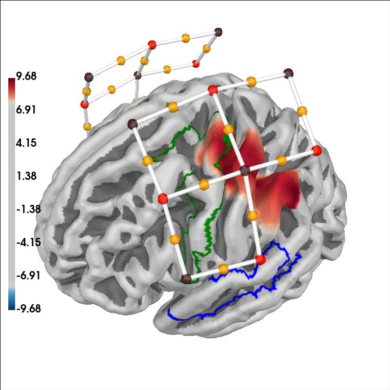 plot 70 visualise brain