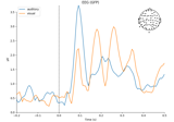 Overview of MEG/EEG analysis with MNE-Python