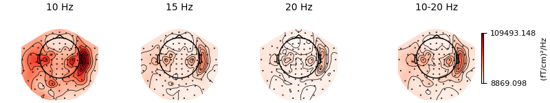 10 Hz, 15 Hz, 20 Hz, 10-20 Hz