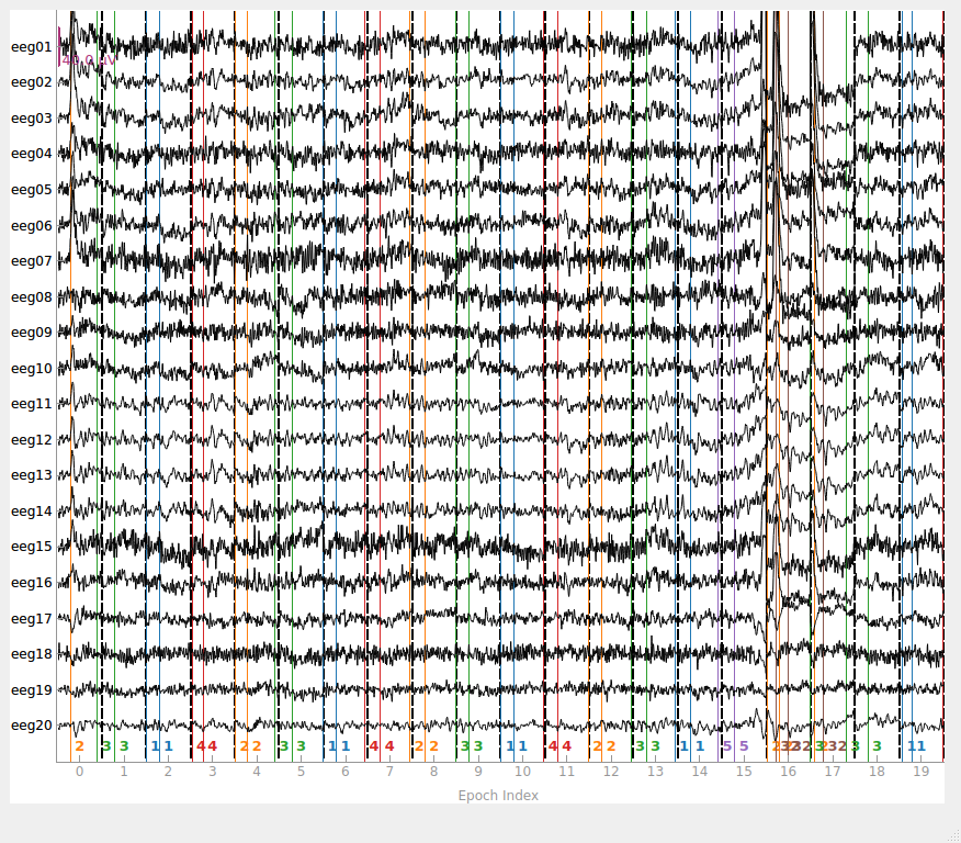 Long-epoch averages showing the ERPs elicited by sequential words