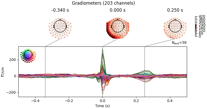 Gradiometers (203 channels), -0.340 s, 0.000 s, 0.250 s