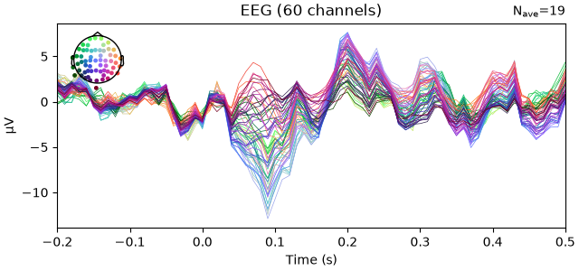 EEG (60 channels)