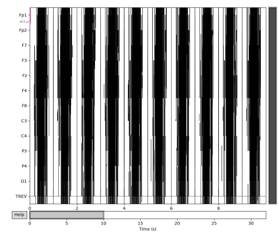58 fmri gradient artifact