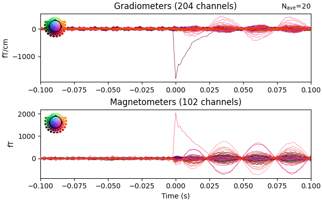 Gradiometers (203 channels), Magnetometers (101 channels)